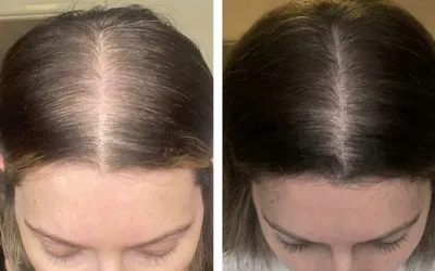 Injectable Solutions Therapy